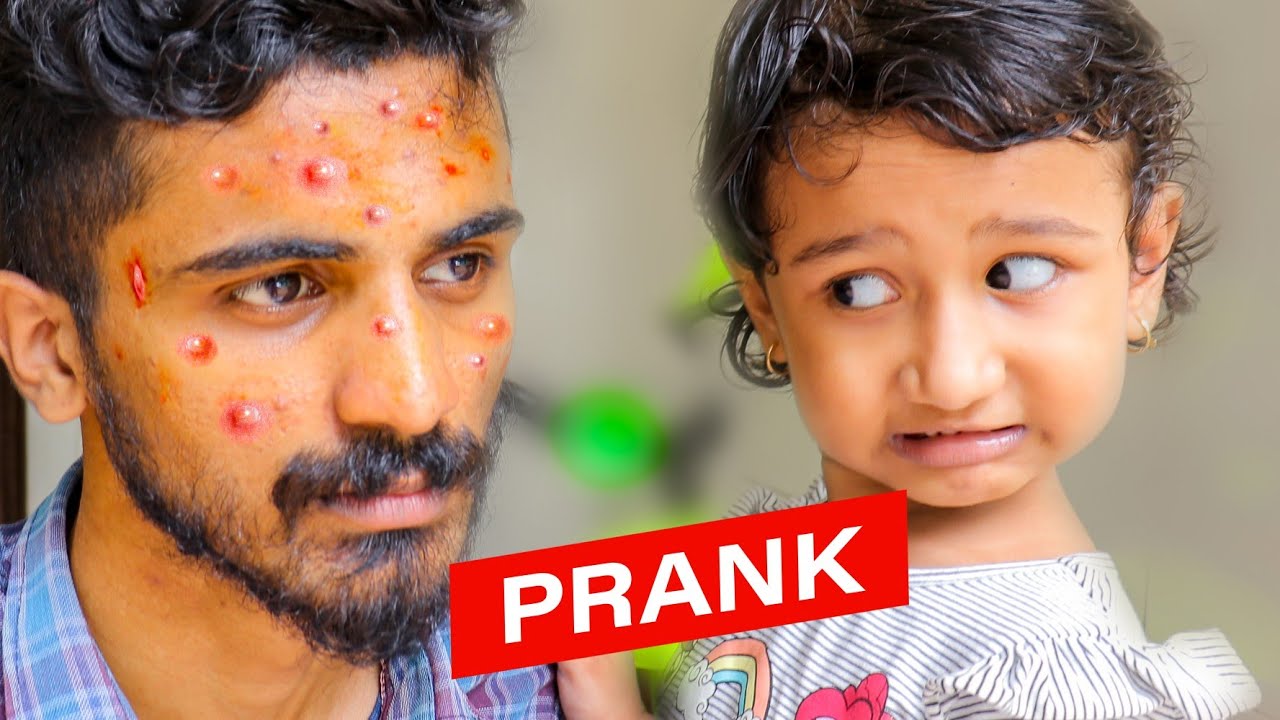 Oh Noo😱 CHICKENPOX PRANK ON ZAIBA 😜 !!
