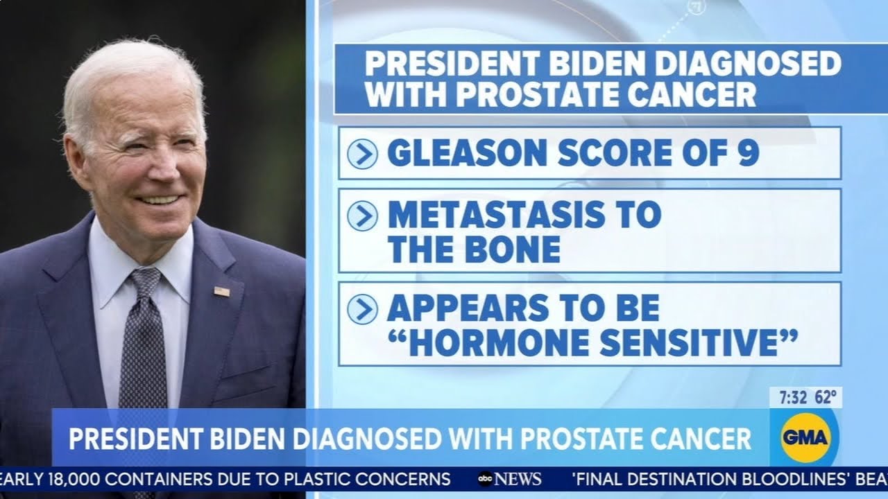 Former President Biden's cancer diagnosis: What does a Gleason score of 9 mean?