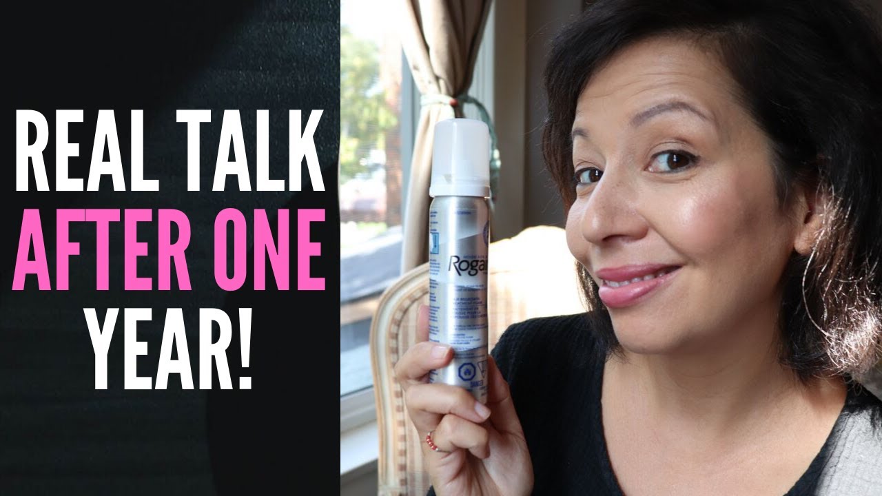 WHAT MY HAIR LOSS LOOKS LIKE AFTER ONE YEAR OF ROGAINE FOAM FOR WOMEN (Check out this growth!)