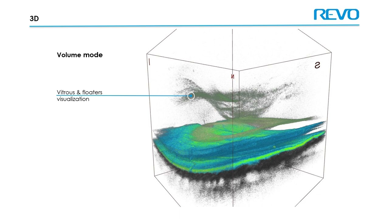 Optopol Revo FC | מכשיר משולב OCT ופונדוס