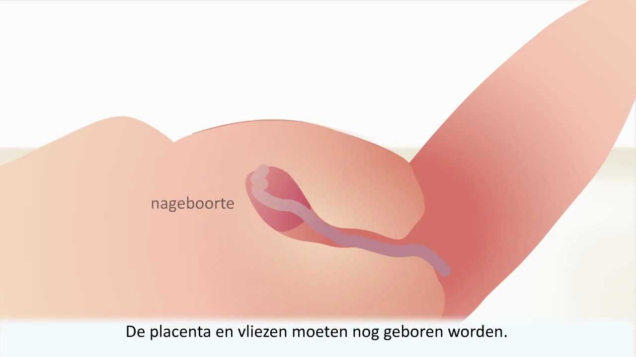 Bevallen - Wat kun je verwachten als je moet bevallen?