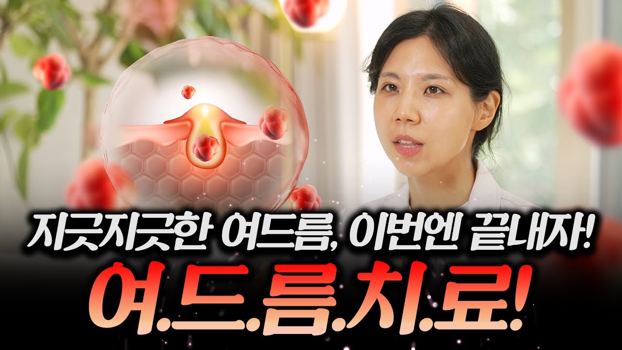 여드름 치료, 원인을 모르면 절대 안 끝납니다🔥 재발성·광범위 여드름 원인과 해결책