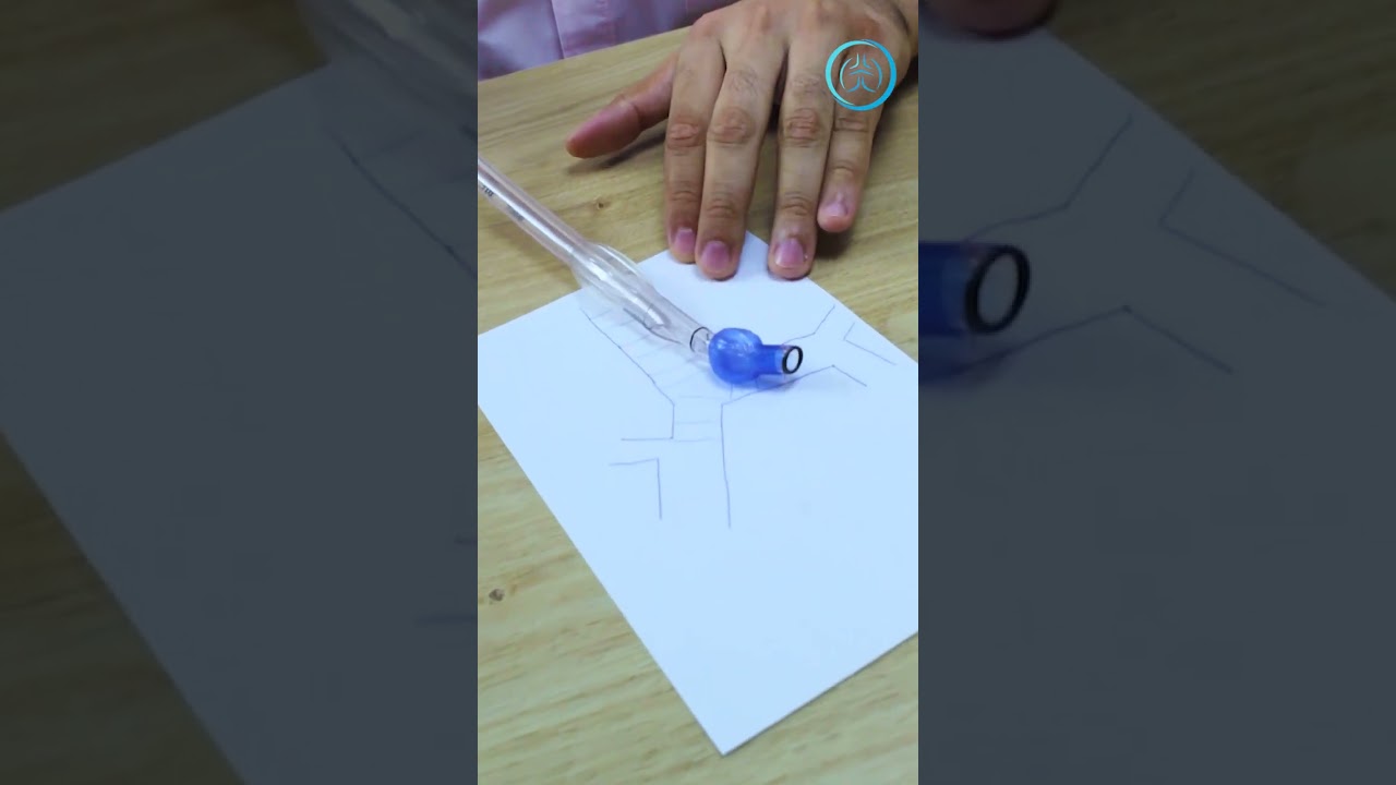 Elementos de una cirugía torácica: TUBO SELECTIVO ENDOTRAQUEAL - Dr. Alejandro Kees