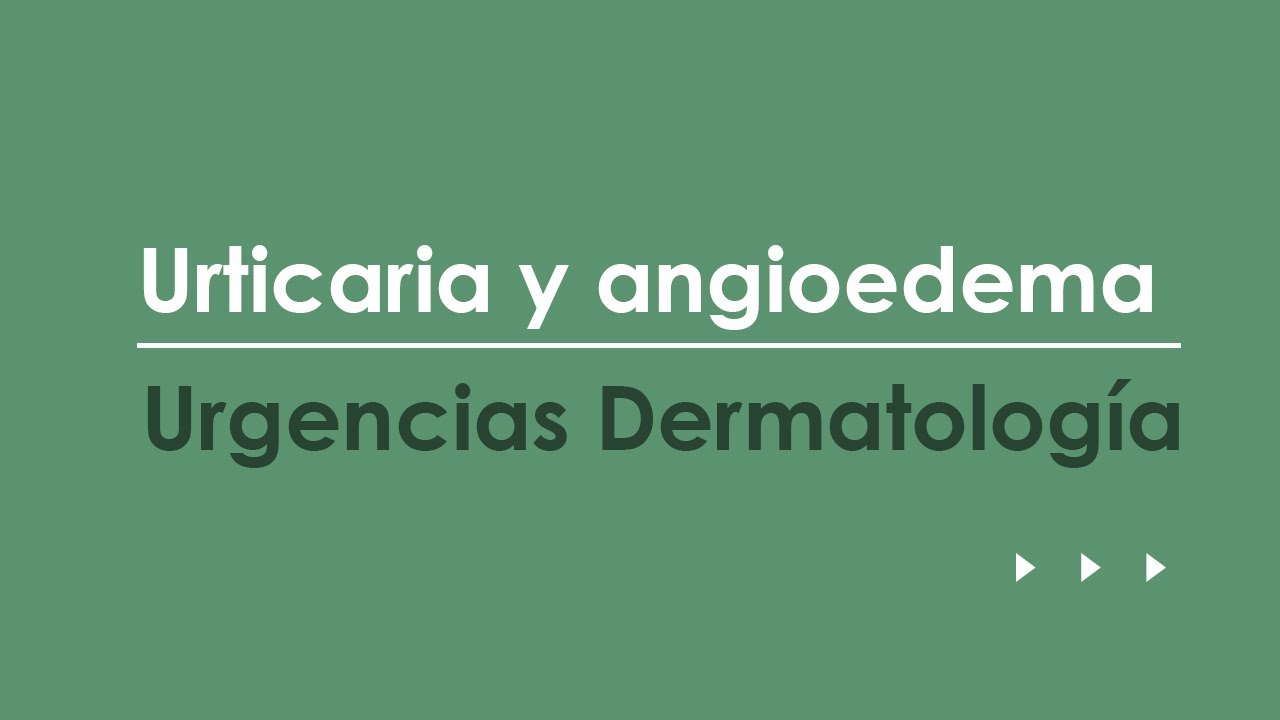 Urticaria y angioedema. Urgencias más frecuentes en Dermatología