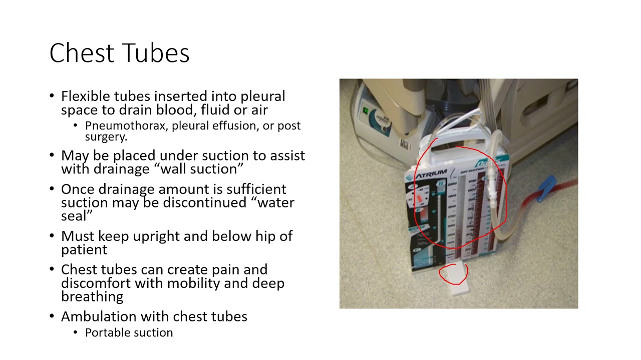 Acute Care Physical Therapy 7: Lines