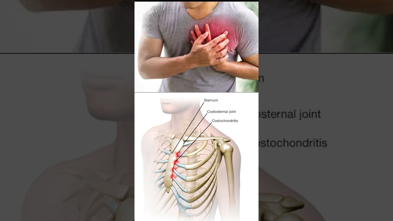 Xabad xanuun jucis u baahan