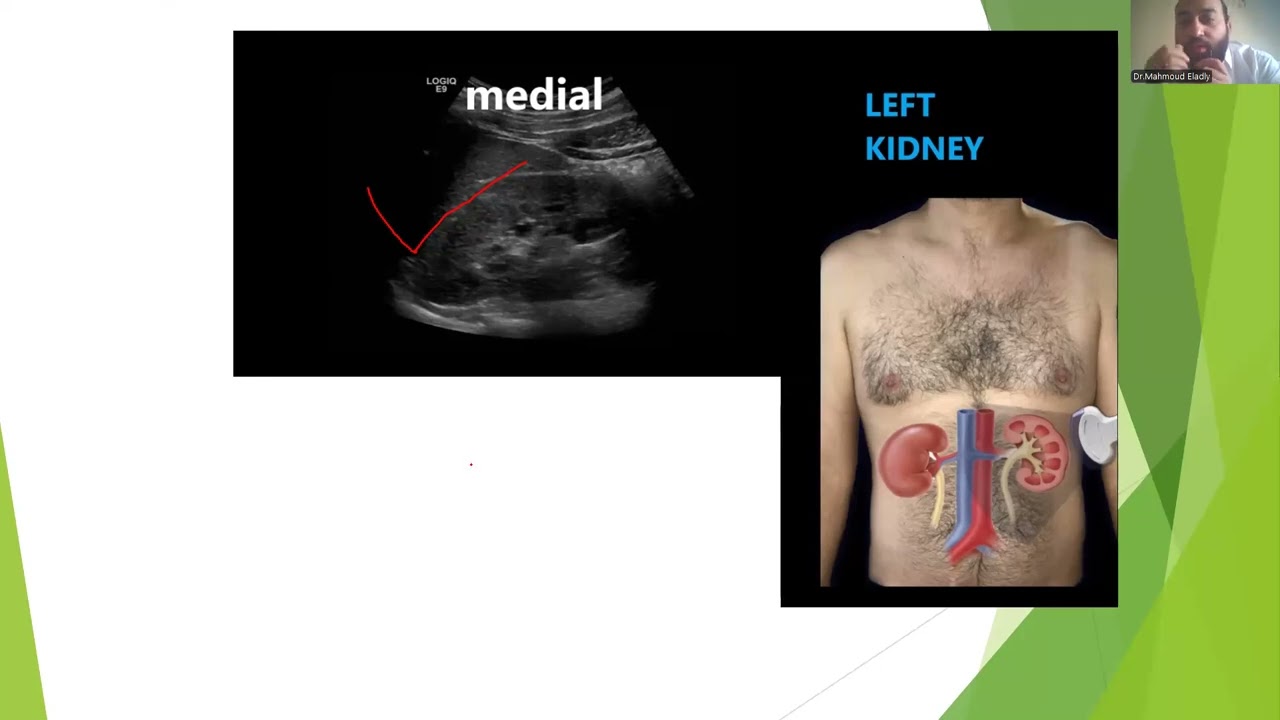 Ascites, FAST exam, solid organ injury. 