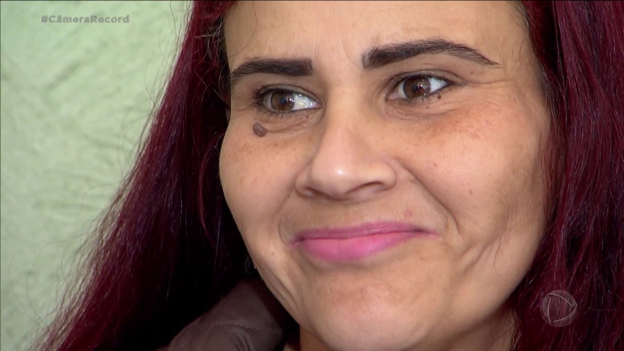 Adriana muda de vida após bariátrica e quer tirar excesso de pele