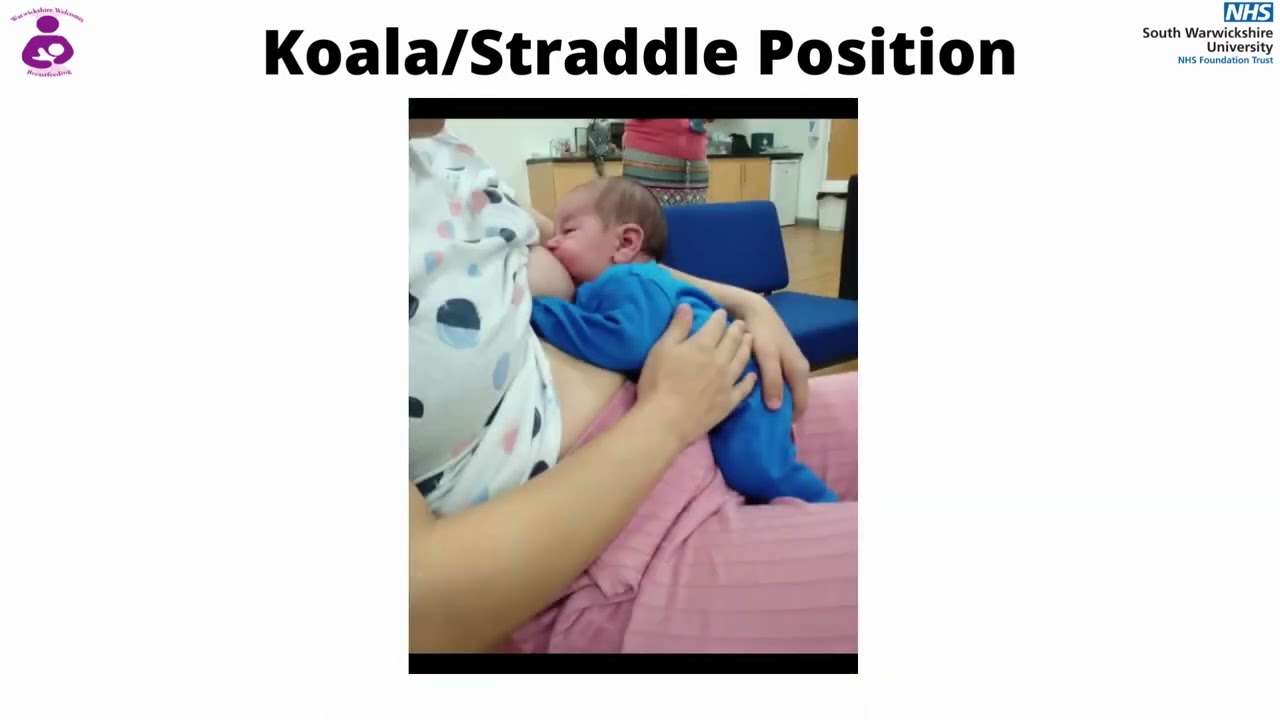 Koala / Straddle breastfeeding position