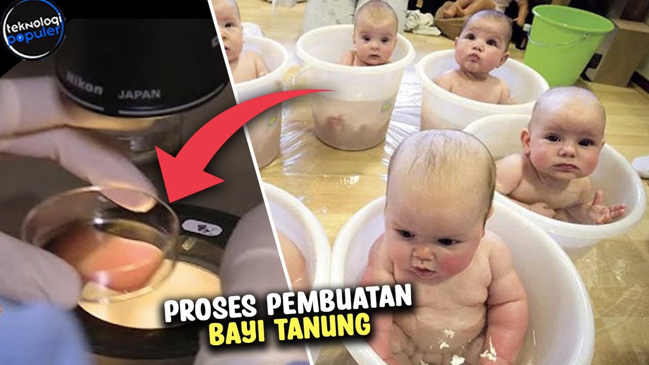 PROGRAM BAYI TABUNG BAHAYA? Ternyata Begini Proses Pembuatan Bayi Tabung dari Awal Hingga Akhir