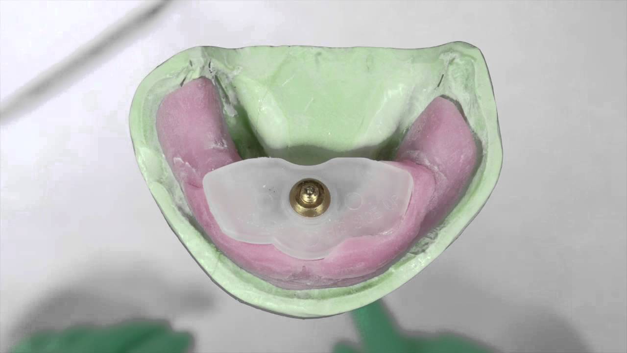 Jaw Recorder Directions for Use