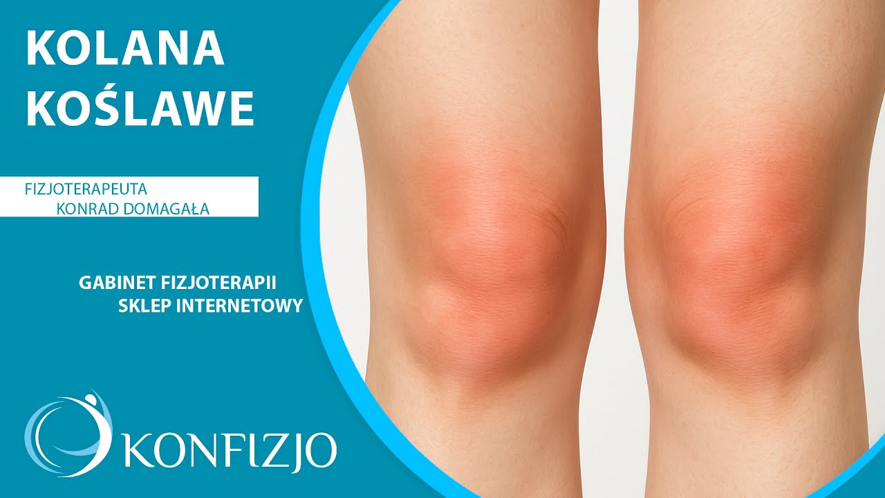 Kolana koślawe – objawy, przyczyny, leczenie i ćwiczenia