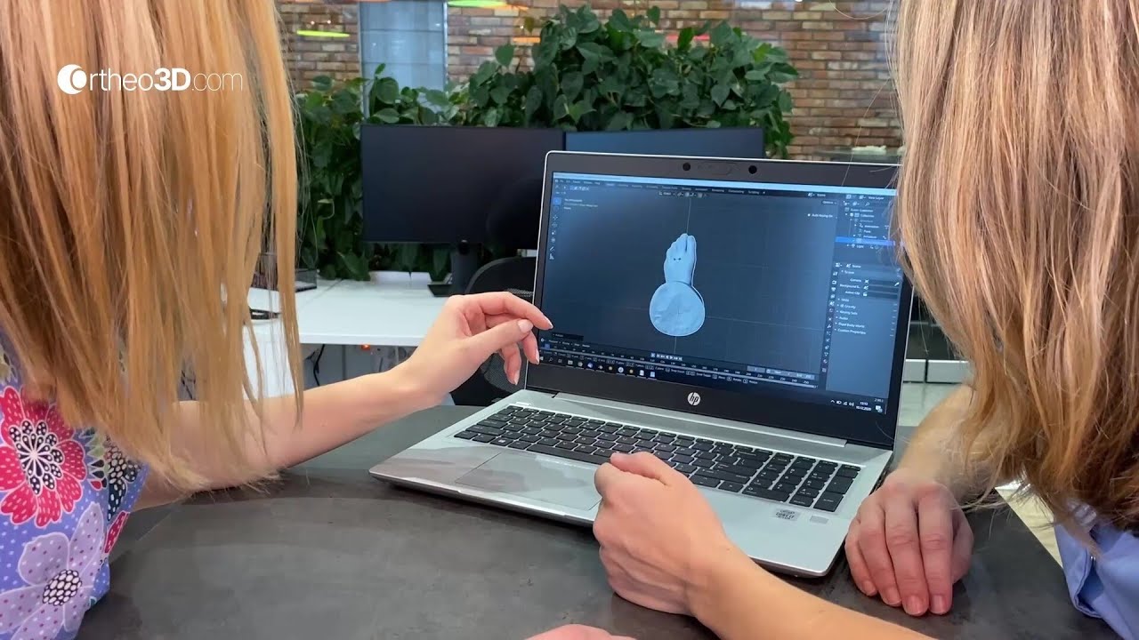 Ortheo 3D - Aplikacja z modułem AI w procesie ortezowania