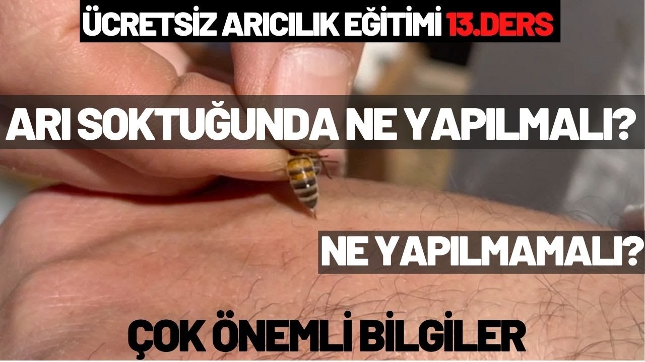 ARI SOKTUĞUNDA NE YAPILMALI? NE YAPILMAMALI? | ELİMİ 2 KERE SOKTURDUM