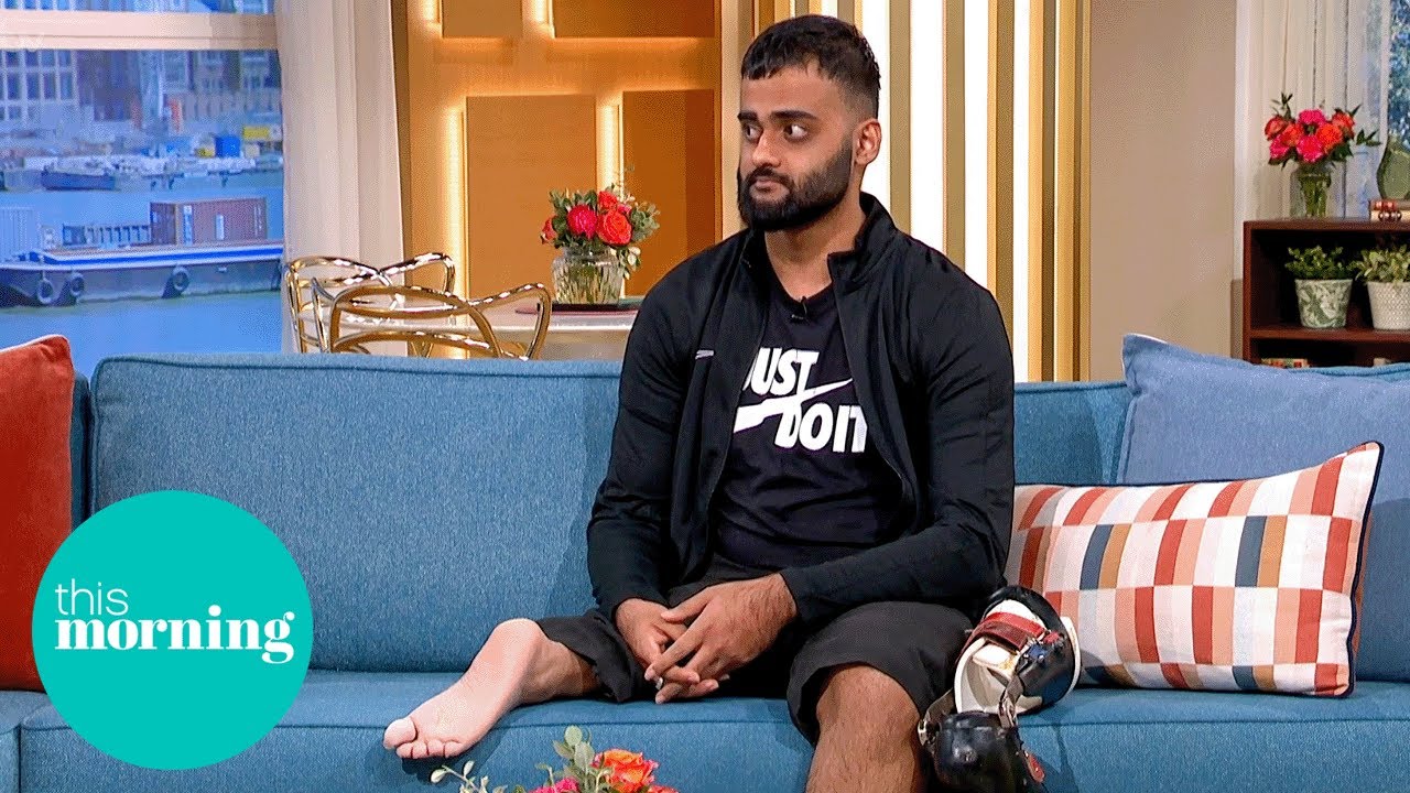 ‘I Had My Leg Amputated and My Foot Sewn On Backwards’ | This Morning