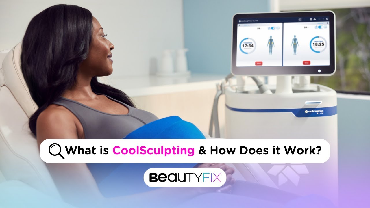 Freezing Off Fat PERMANENTLY With CoolSculpting Elite | BeautyFix