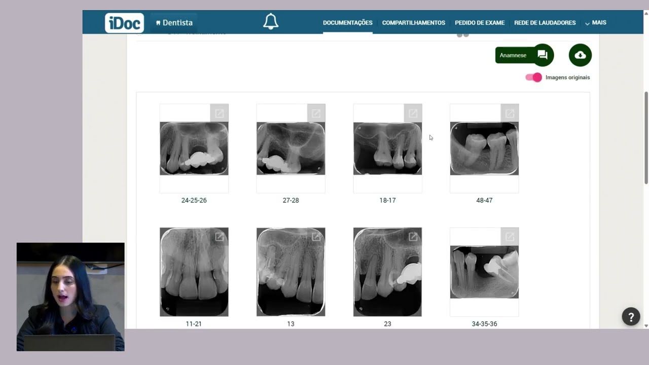 Desvendando o iDoc - Visualizando a Periapical de boca toda