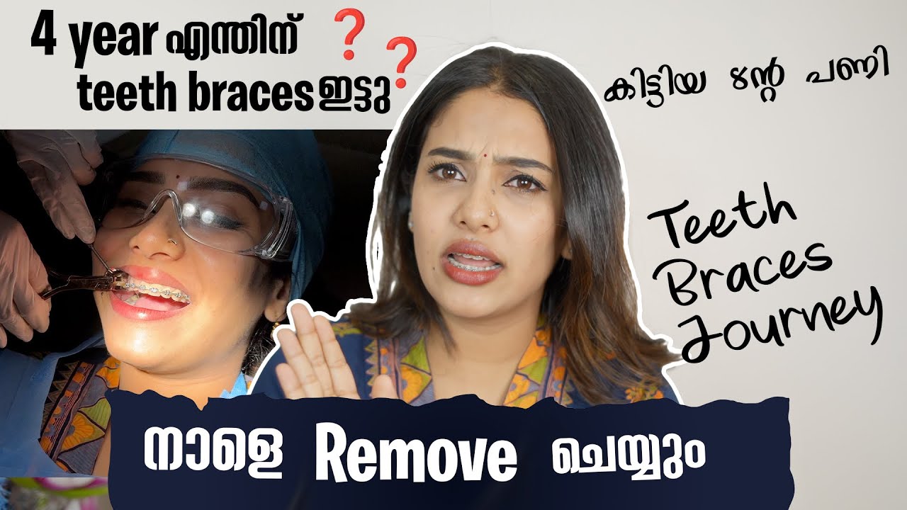 4 വർഷത്തെ കാത്തിരുപ്പ് 😳🦷പല്ലിൽ കമ്പി ഇളക്കാൻ പോണ് 😳💯#glamyganga 