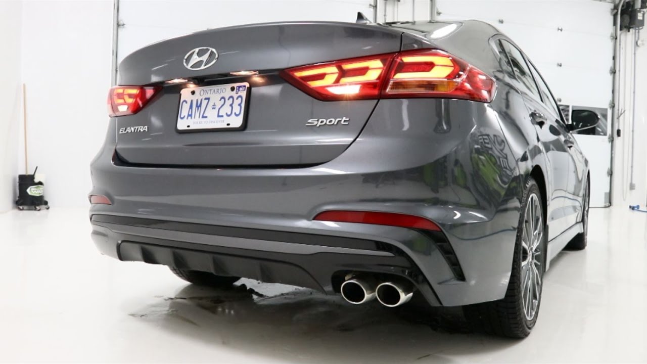 2017 Hyundai Elantra Sport Exterior | THE Most Complete review Part 1/6