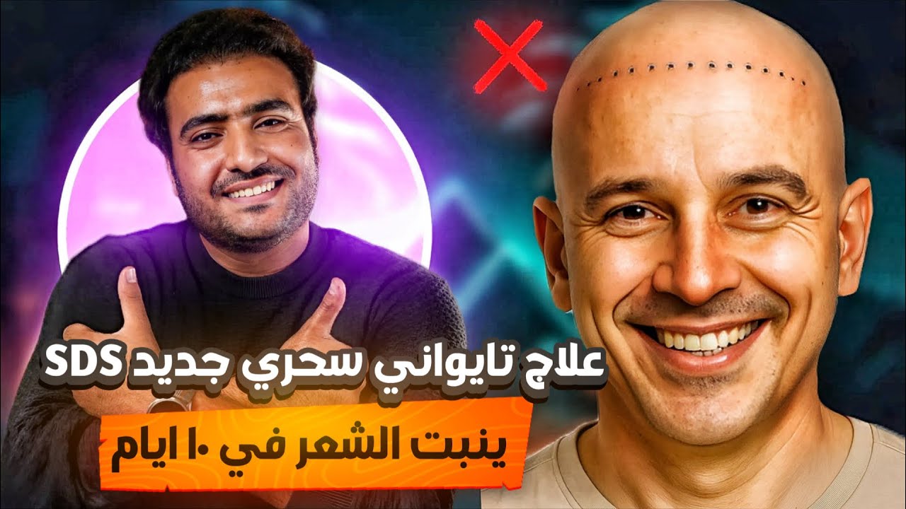اخيراااااا علاج تايواني سحري بديل زراعة الشعر ينبت الشعر في ١٠ ايام I برنامج البسيط