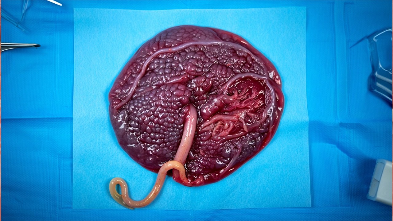 How the Placenta Forms and Works