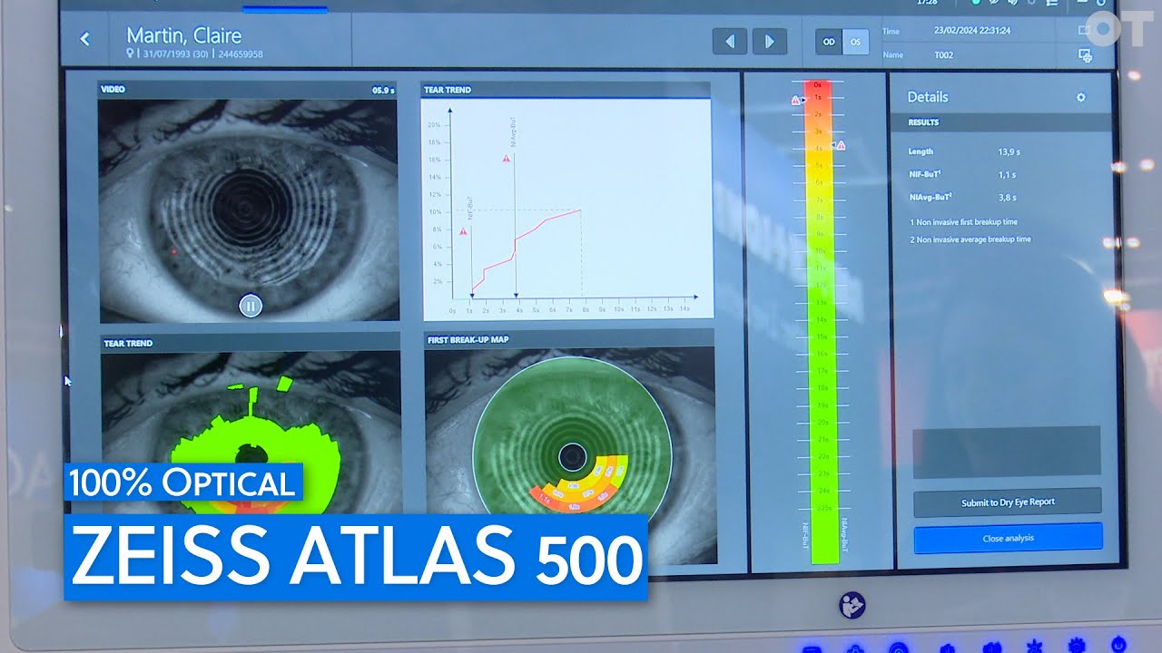 Four in one dry eye measurement device: Zeiss Atlas 500