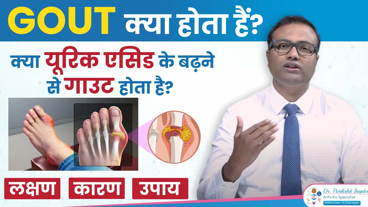 What is Gout? | गाउट क्या होता है? | जानिए लक्षण, कारण और उपाय | By Dr Parikshit Sagdeo