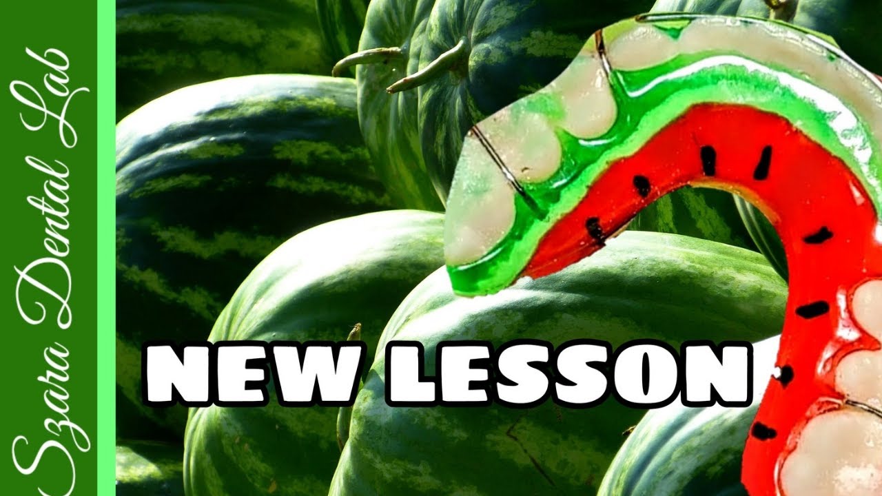 NEW Watermelon Retainer Design by Szara Dental