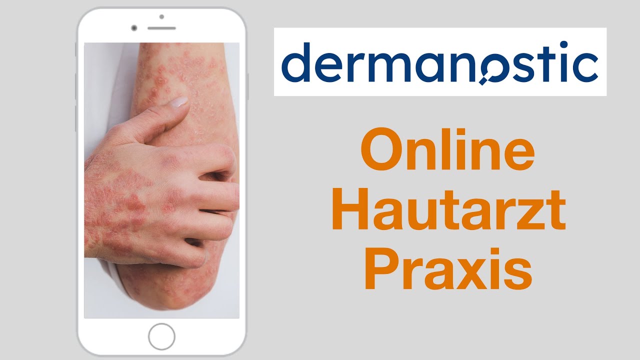 Den Hautarzt auf dem Handy mit Dermanostic