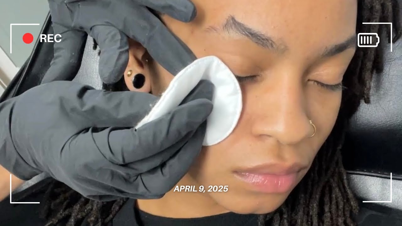 I got a face dermal piercing | footage + healing update