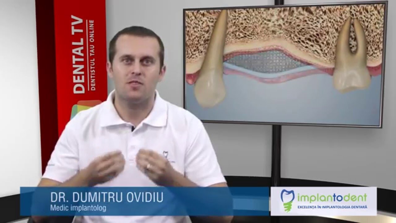 Aditia si augmentarea osoasa - Dr. Dumitru Ovidiu