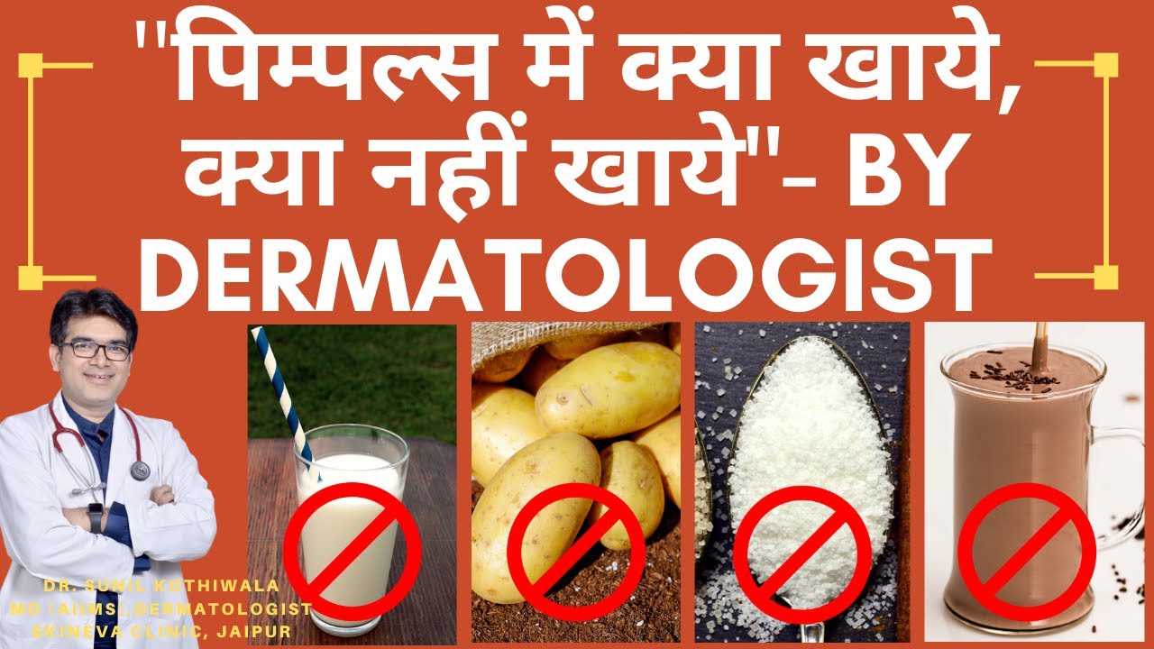 पिम्पल्स में क्या खाना चाहिए | Acne Diet Plan | Worst Foods For Acne | Top Foods That Cause Acne