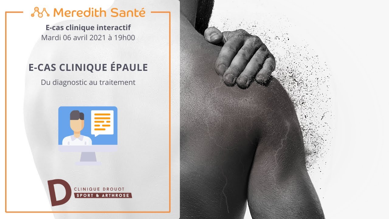 Les E-Cas Clinique de Drouot : CAS CLINIQUE EPAULE #2