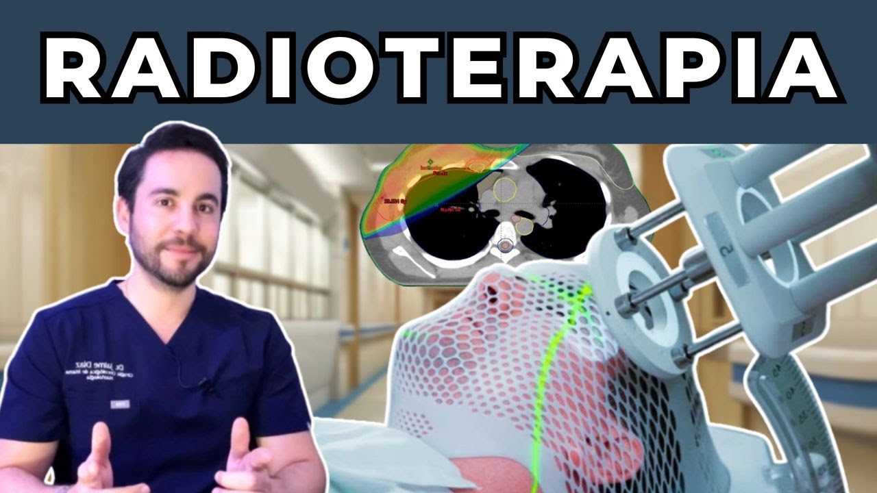 Radioterapia en Cáncer de Mama: Lo que necesitas saber explicado fácil