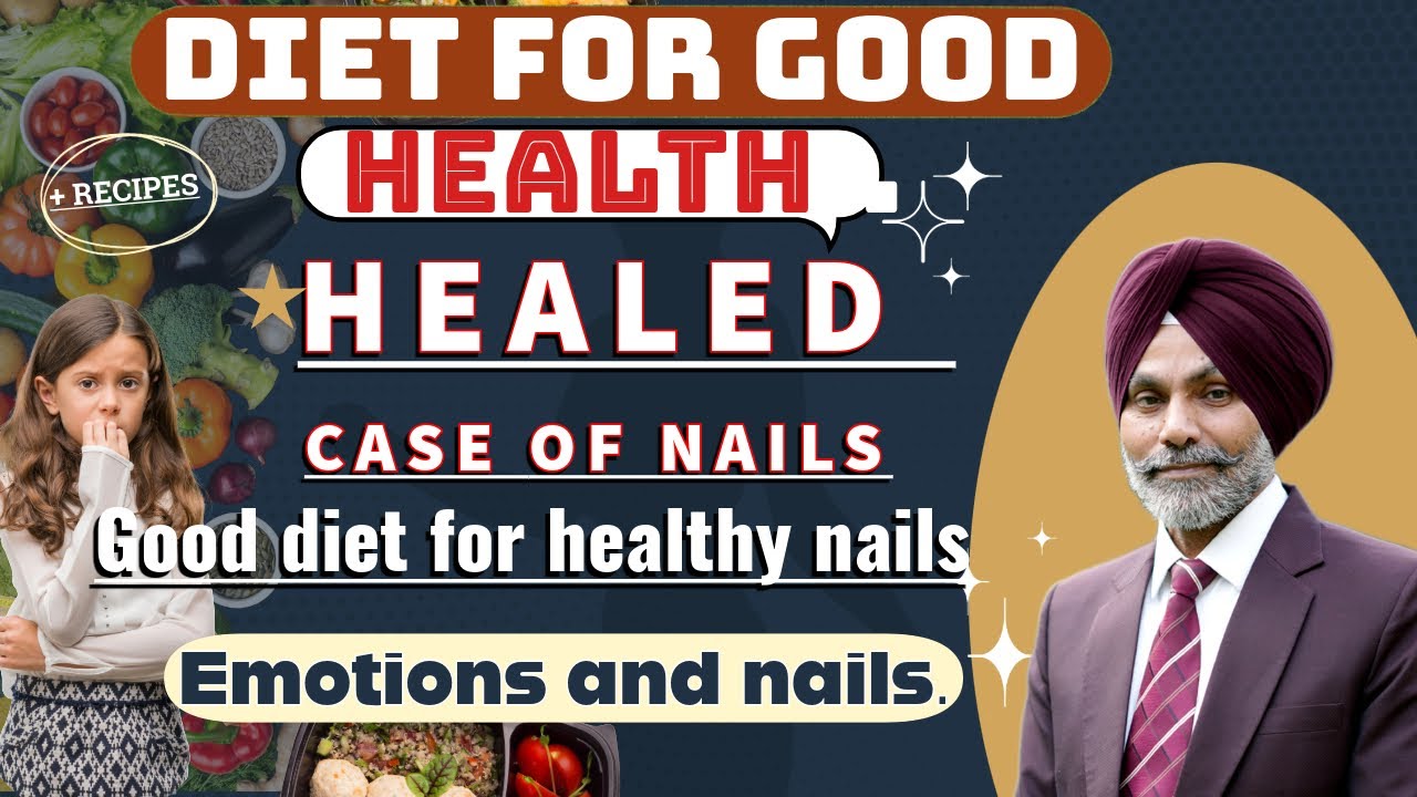 Diet for good health | Good diet for healthy nails | Diet plain | Emotions and nails | Healthy nails