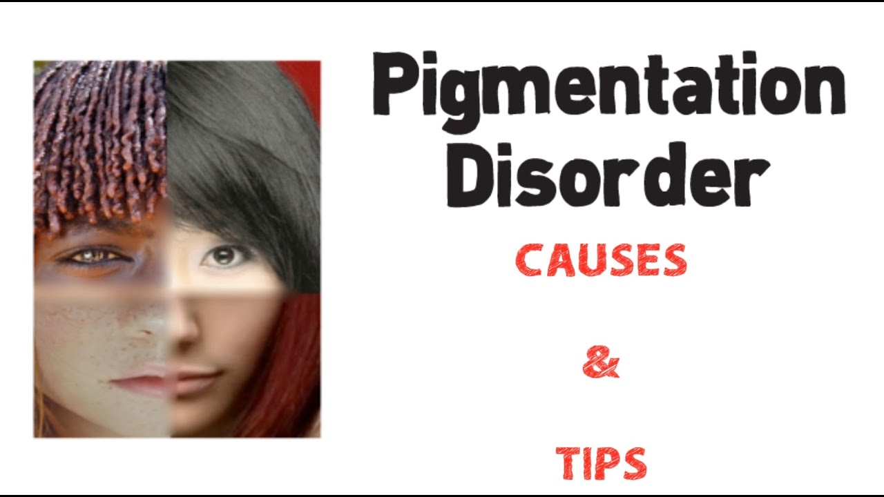 Skin Pigmentation-Ingredients: what to look for?