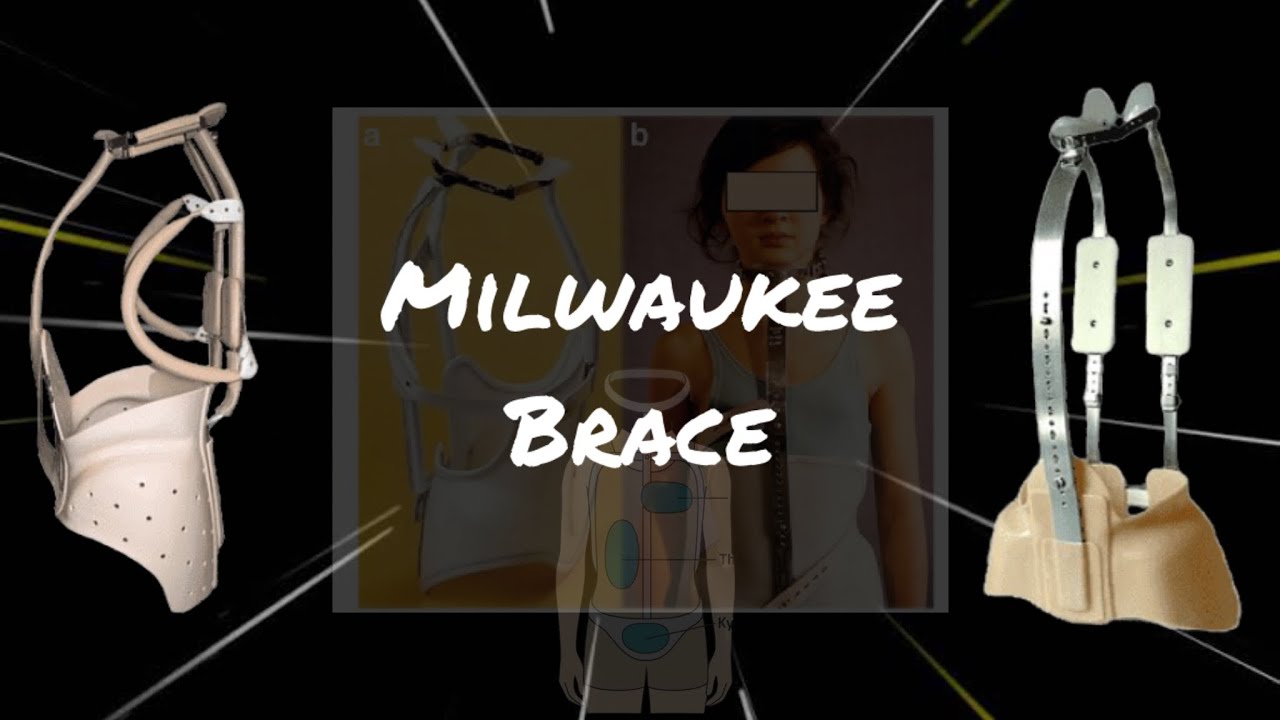 MILWAUKEE BRACE / PT IN CBR