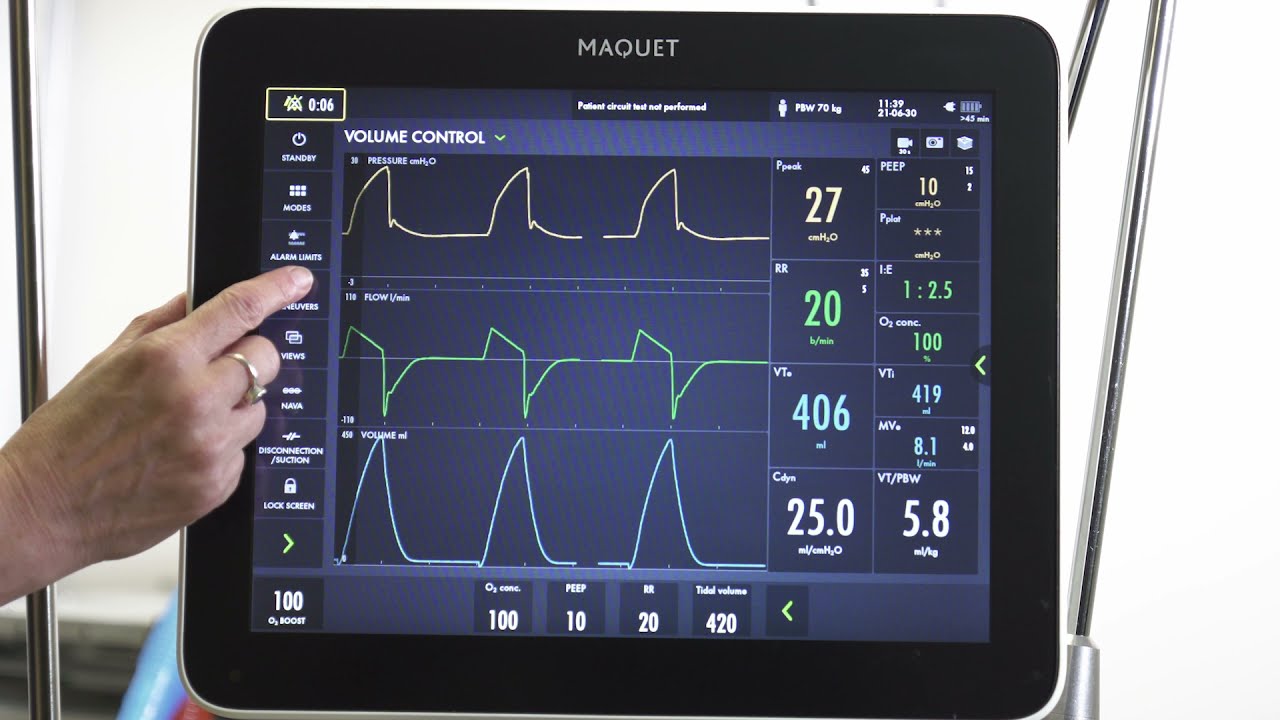Initial Ventilator Management: Hypoxemic respiratory failure/ARDS
