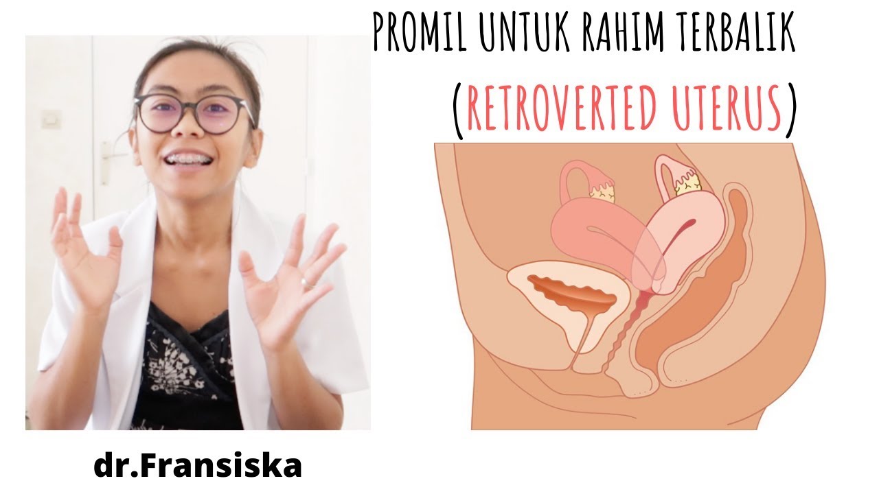 TIPS PROMIL  UNTUK RAHIM RETRO (TERBALIK), MIRING, ATAU RETROVERTED UTERUS