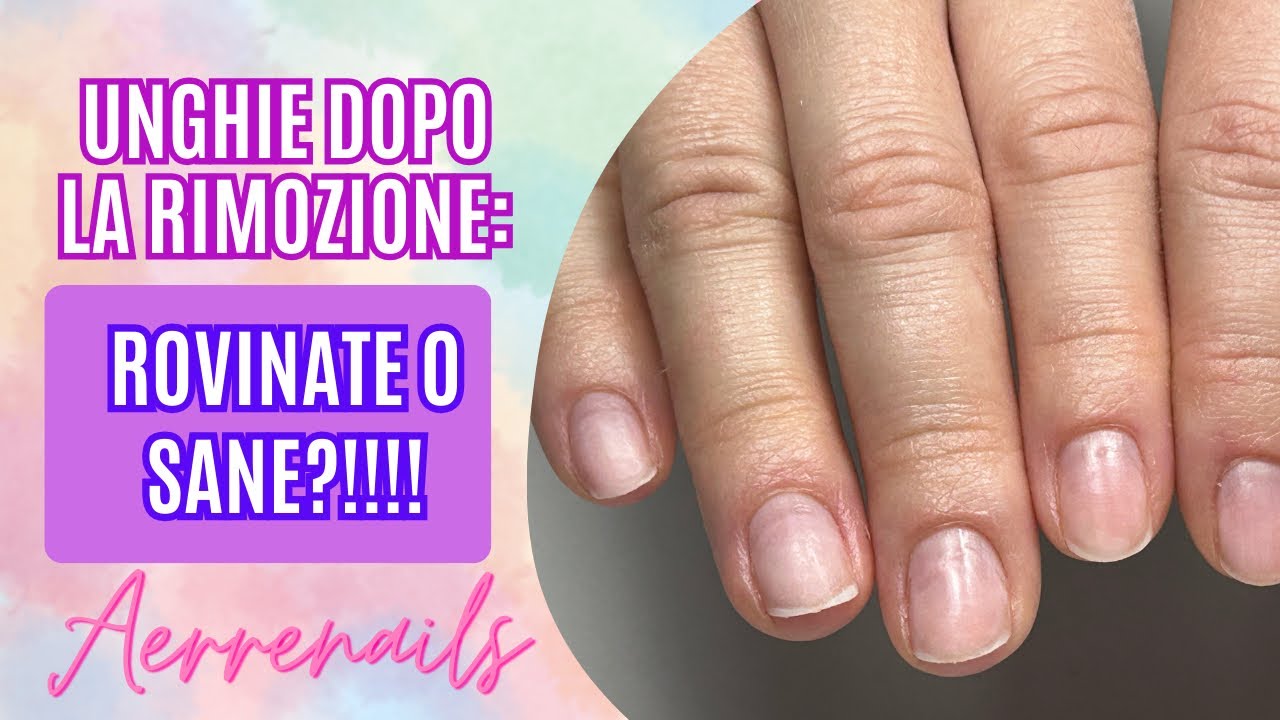 UNGHIE DOPO LA RIMOZIONE: ROVINATE O SANE?!!…