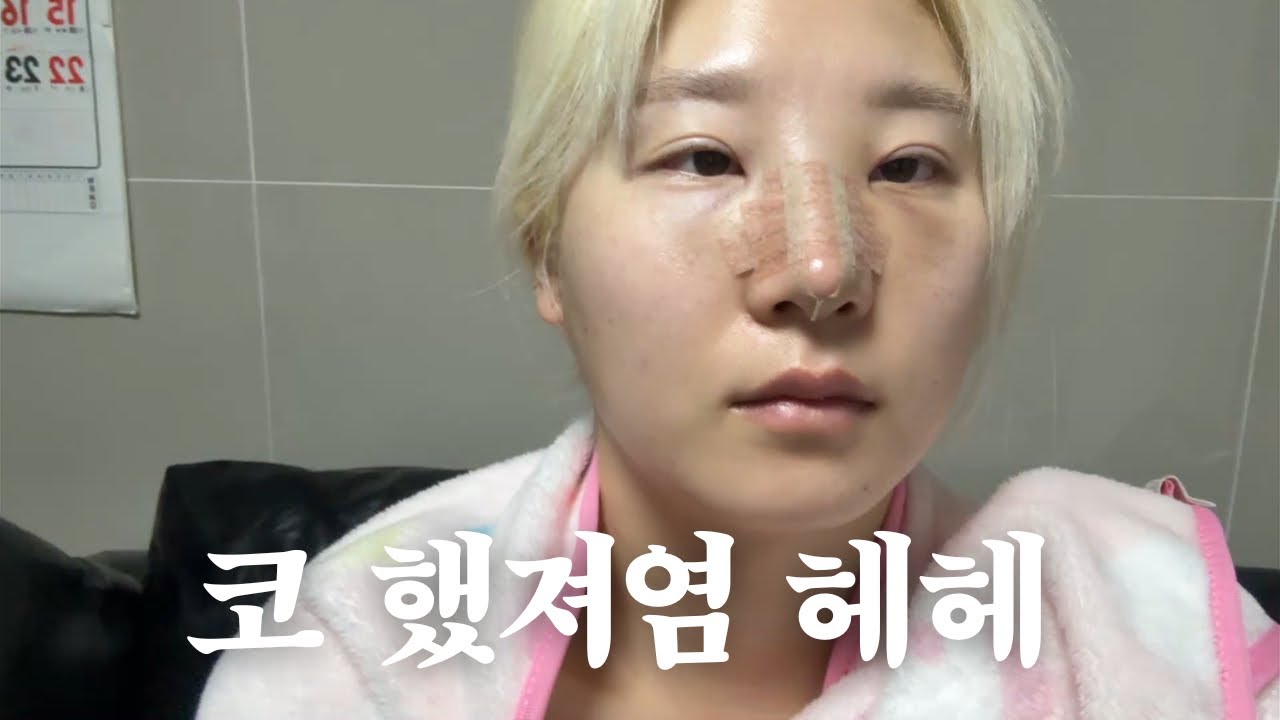 다이어트 한다더니 코수술 하고 온 민철이 브이로그