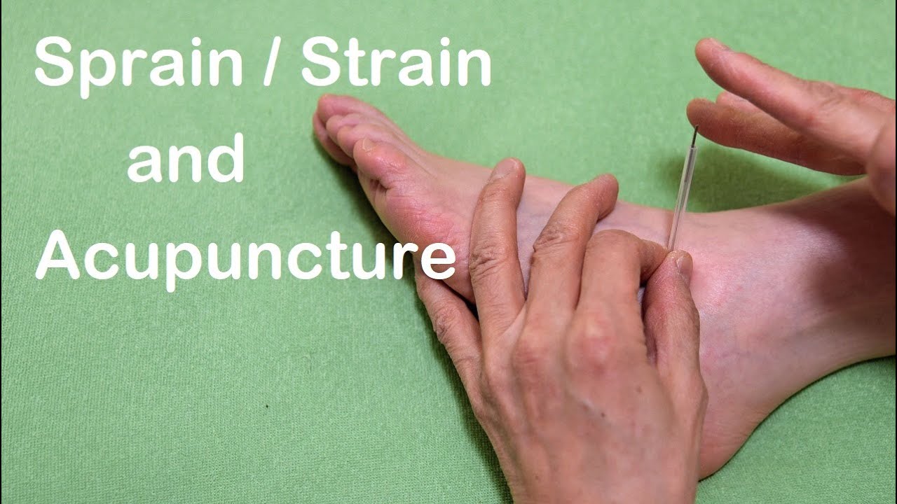 Ankle Sprain / Strain and Acupuncture Treatment