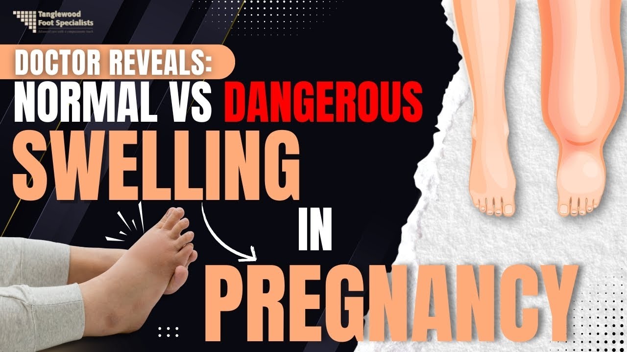 Doctor Reveals: Normal vs Dangerous Swelling in Pregnancy