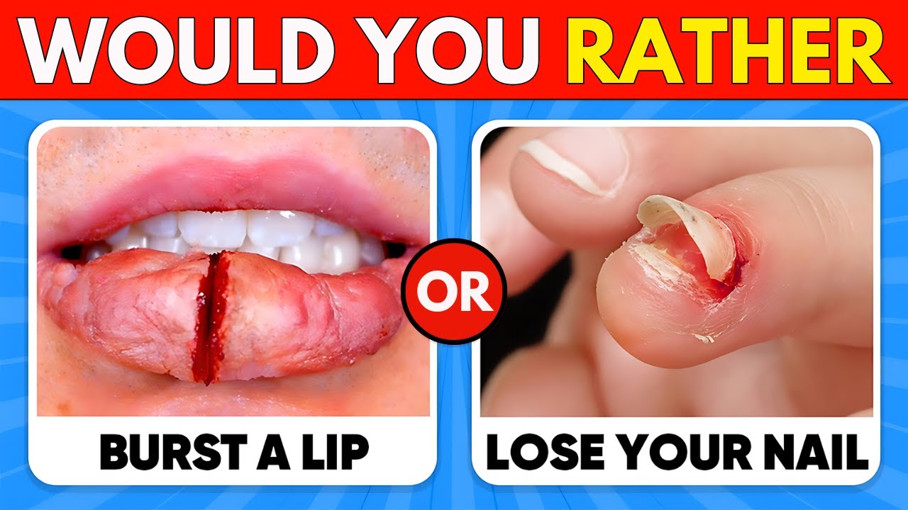 Would You Rather    HARDEST Choices Ever! ⚠️😱 ASMR Quiz Dino