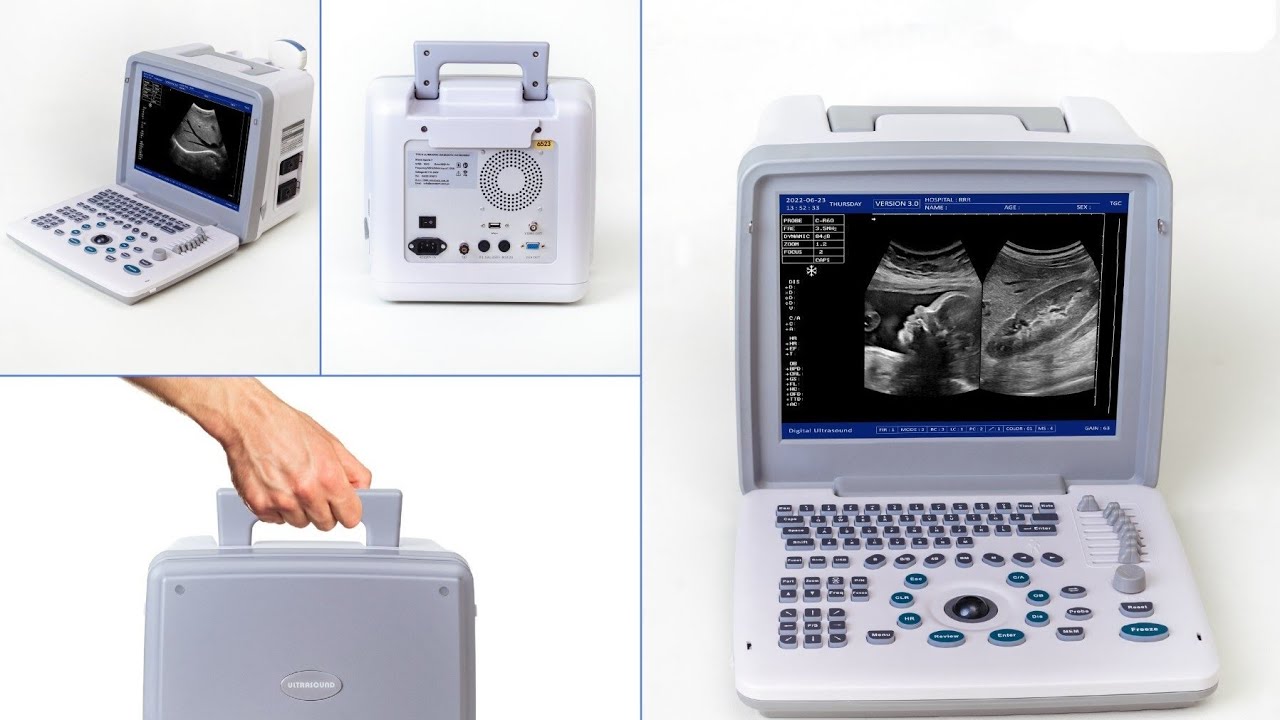 Function 2 Apollo 7 ultrasound machine  Best price in Pakistan Sonotech Best import prices Sonotech