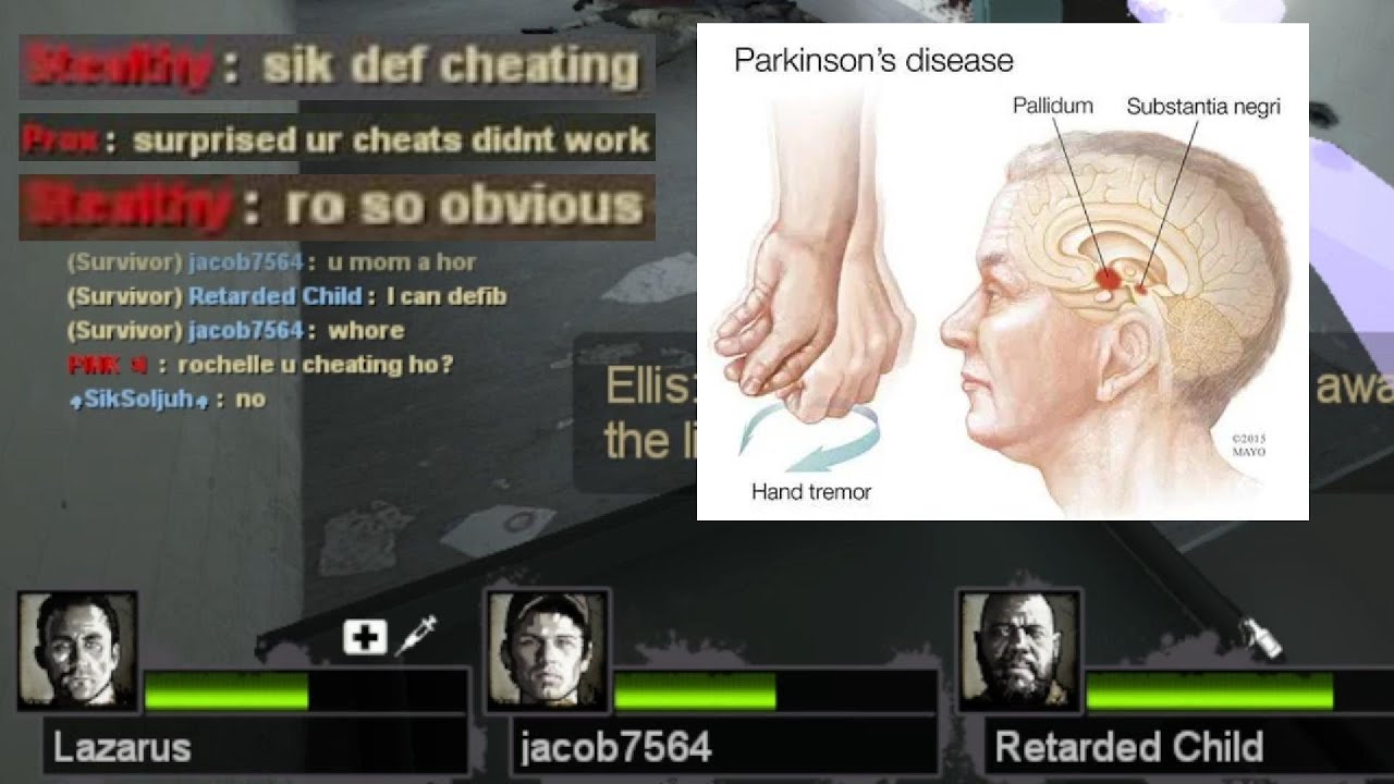 l4d2 after parkinson's disease