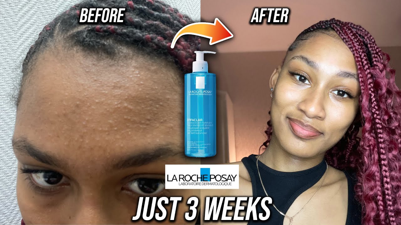 Я попробовала очищающий гель La Roche-Posay Effaclar // РЕЗУЛЬТАТЫ МЕНЯ ПОТРЯСЛИВЫ // Обзор La Ro...