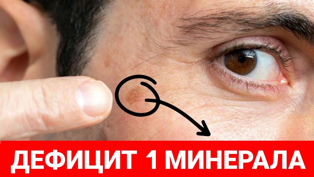 В ЭТОМ КРОЕТСЯ ПРИЧИНА ПИГМЕНТНЫХ ПЯТЕН НА РУКАХ!
