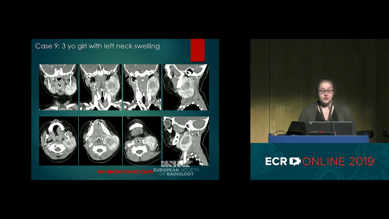 Differencial Diagnosis of Pediatric Neck Lesion