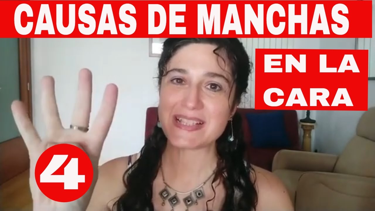 4 CAUSAS DE MANCHAS EN LA CARA  😳   &iquest;A QUI&Eacute;NES SALEN? &iquest;C&Oacute;MO DIFERENCIARLAS?